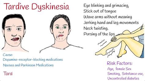 abilify lawsuit tardive dyskinesia|does abilify cause tardive dyskinesia.